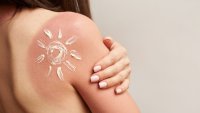15 експертни съвета за успокояване на слънчево изгаряне