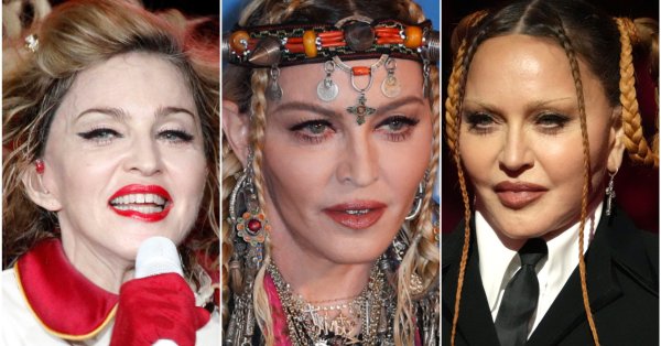 Снимка: Лицето на Мадона – с ринопластика, филъри и ботокс