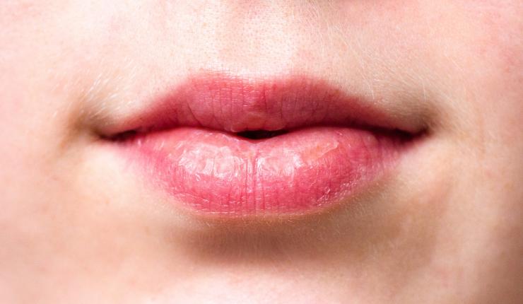 Балсам за устни: 7-те най-добри съставки срещу сухота - Tialoto