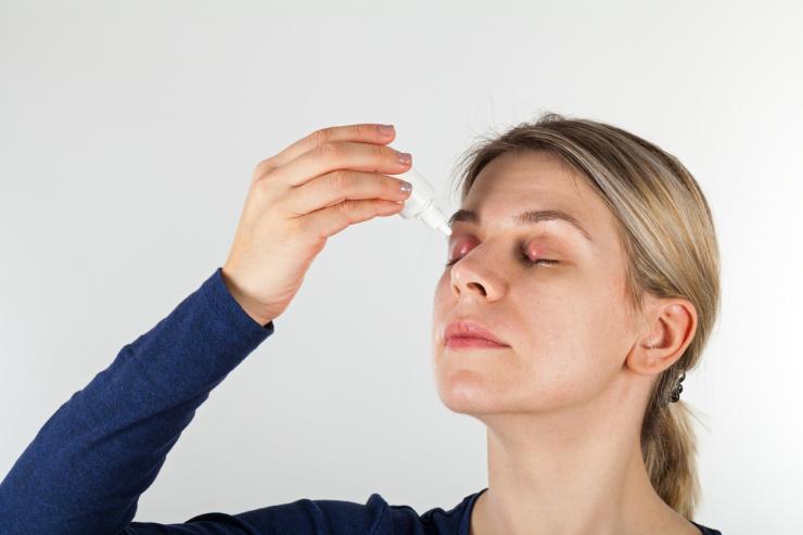Ечемик на окото – какво го причинява и как да се лекуваме - Tialoto